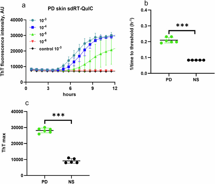 A same day α-synuclein RT-QuIC seed amplification assay for synucleinopathy biospecimens.