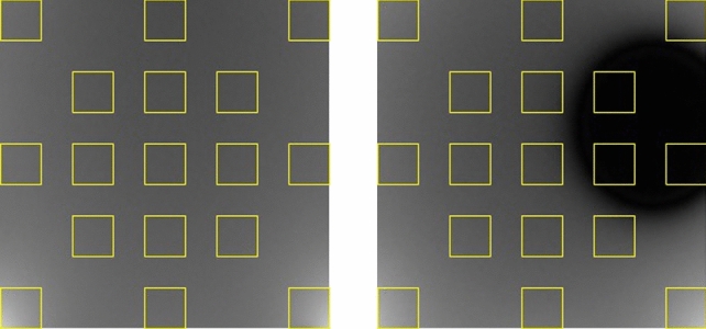 Effect of metallic materials on magnetic resonance image uniformity: a quantitative experimental study.