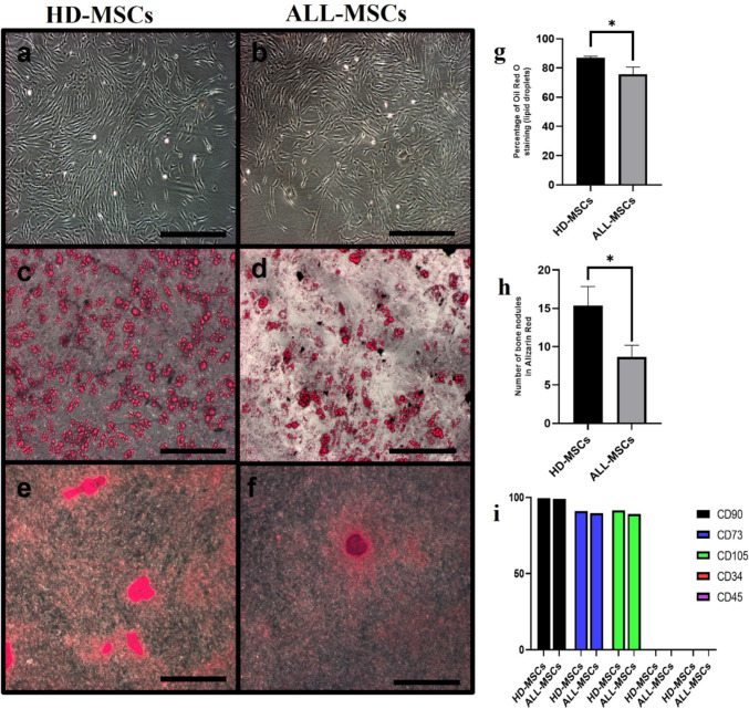 The dynamic interaction of pediatric ALL cells and MSCs: influencing leukemic cell survival and modulating MSC β-catenin expression.