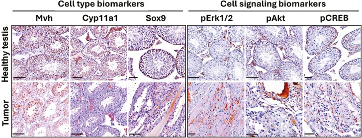 Testicular sex cord-stromal tumors in mice with constitutive activation of PI3K and loss of Pten.