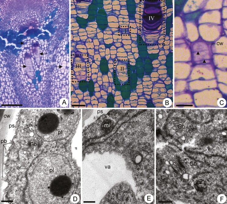 Interconnected idioblasts in <i>Peltaea polymorpha</i>: a novel component of the mucilage-secretory apparatus in Malvaceae.