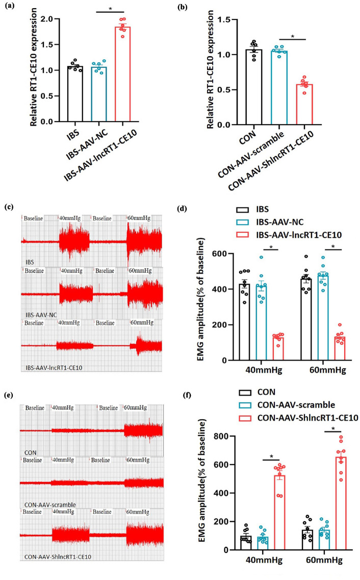 The involvement of spinal lncRNA RT1-CE10 in chronic functional visceral pain.
