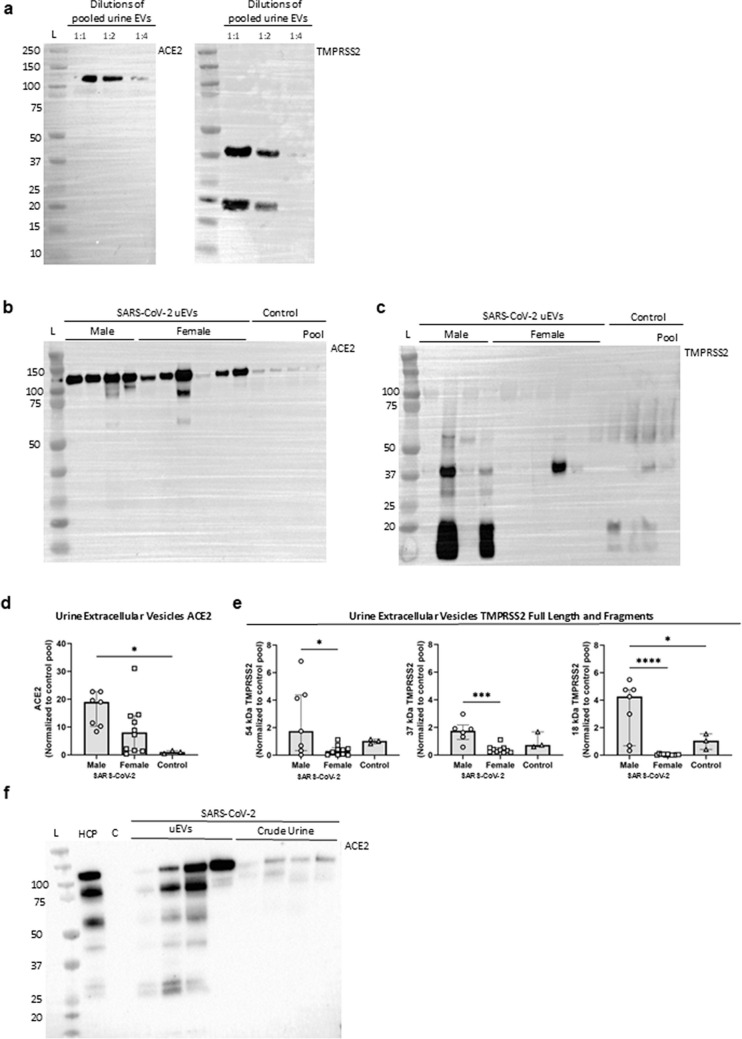 ACE2 and TMPRSS2 in human kidney tissue and urine extracellular vesicles with age, sex, and COVID-19.