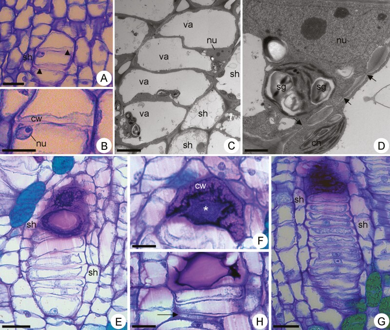 Interconnected idioblasts in <i>Peltaea polymorpha</i>: a novel component of the mucilage-secretory apparatus in Malvaceae.