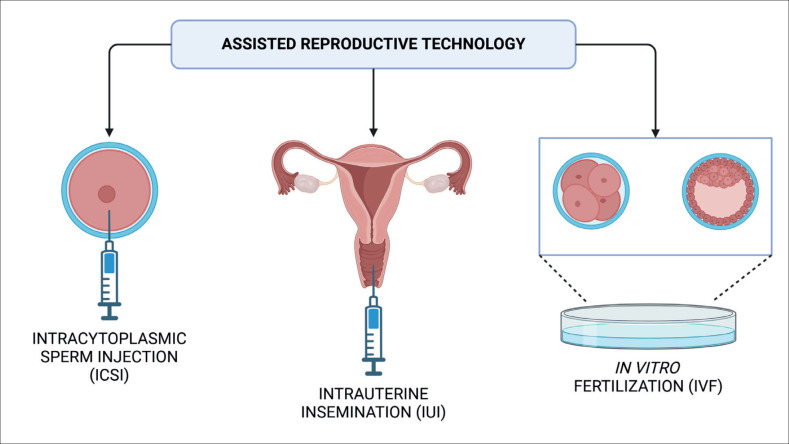 Infertility - a Great Challenge of the Past, Present, and Future.