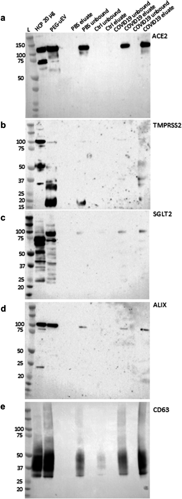 ACE2 and TMPRSS2 in human kidney tissue and urine extracellular vesicles with age, sex, and COVID-19.