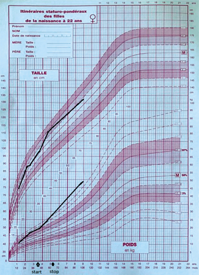 Association of ring chromosome 18 and Prader-Willi syndrome: the first described case report.