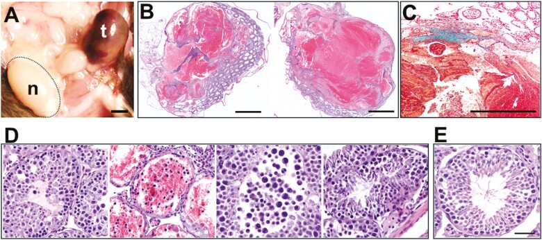 Testicular sex cord-stromal tumors in mice with constitutive activation of PI3K and loss of Pten.