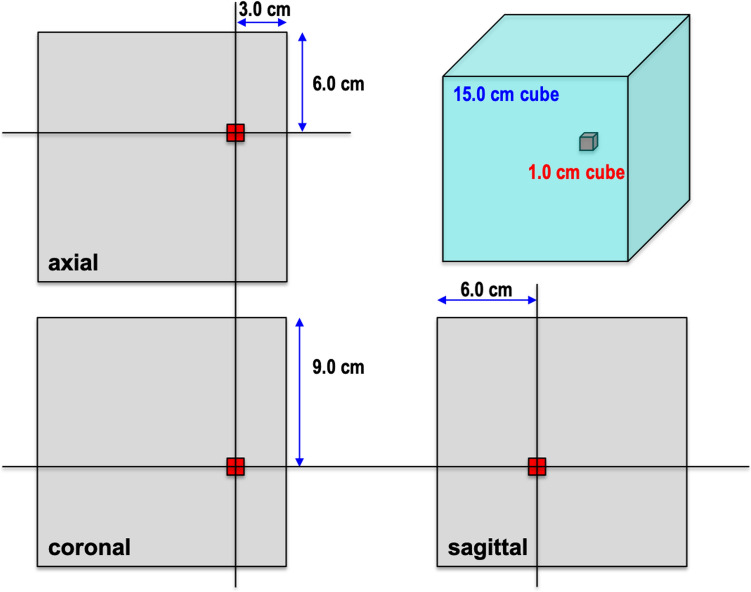 Effect of metallic materials on magnetic resonance image uniformity: a quantitative experimental study.