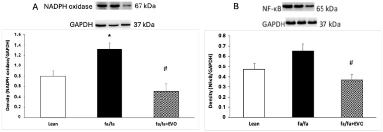 Evolocumab Reduces Oxidative Stress and Lipid Peroxidation in Obese Zucker Rats.