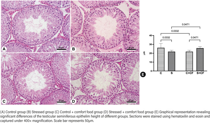 Effects of Chronic Stress and Comfort Food in Testicular Morphology in Adult Wistar Rats.