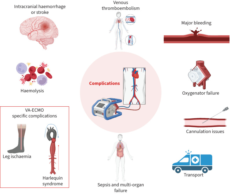 Extracorporeal membrane oxygenation for adults with respiratory failure secondary to cardiorespiratory disease: evolving indications and clinical practice.