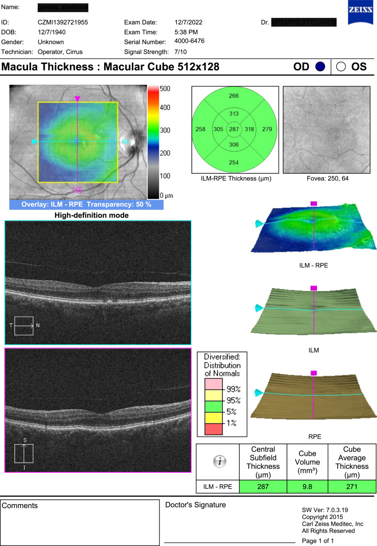 Cefuroxime-Induced Toxic Maculopathy after Intracameral Injection of Standard Dose: A Case Report.