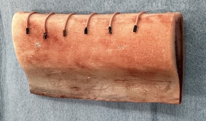 Usefulness of a novel density measurement drill for evaluating cancellous bone density: correlation between CT value and drilling torque value in bovine ribs.