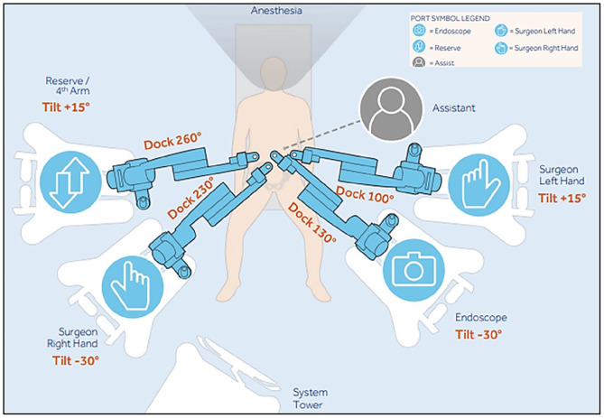 Robotics-assisted surgery in gynecology: A single-center experience with the Hugo™ RAS system in India.