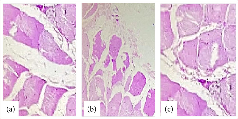 Intravenous meropenem and intraperitoneal use of 10% aqueous extract of Schinus terebinthifolius Raddi (Anacardiaceae) in elderly rats after induction of autogenous fecal peritonitis.