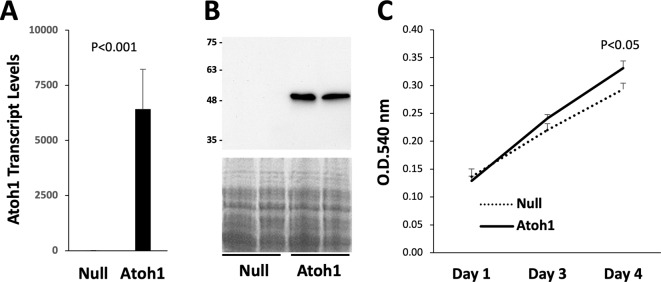 The proneural transcription factor Atoh1 promotes odontogenic differentiation in human dental pulp stem cells (DPSCs).
