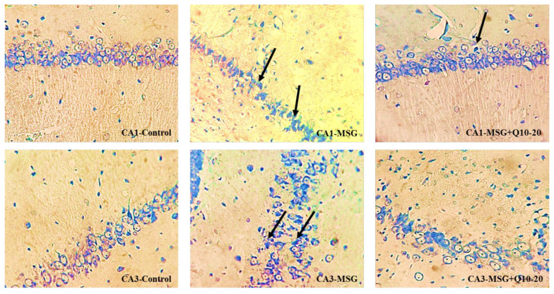 The Impact of Coenzyme Q10 on Cognitive Dysfunction, Antioxidant Defense, Cholinergic Activity, and Hippocampal Neuronal Damage in Monosodium Glutamate-Induced Obesity.