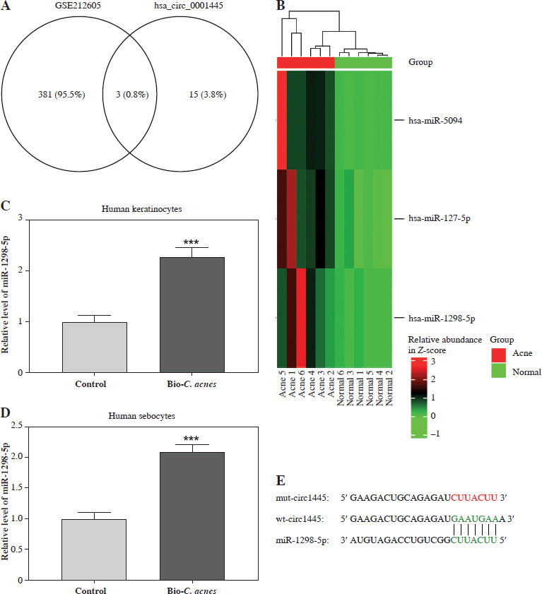 Hsa_circ_0001445 regulates acne inflammation <i>via</i> sponging miR-1298-5p targeting ESR1.