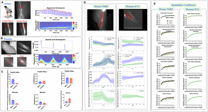 A multiresolution approach with method-informed statistical analysis for quantifying lymphatic pumping dynamics.