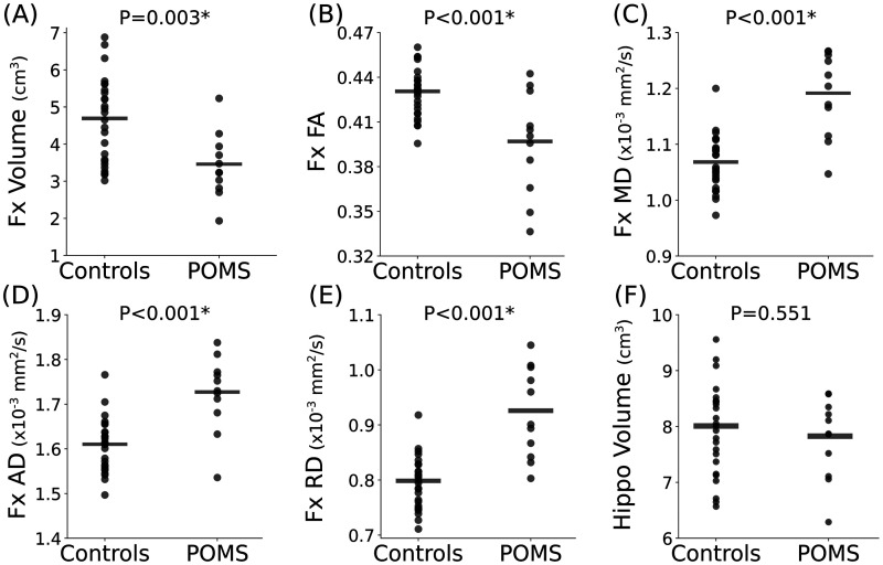 Disproportional smaller fornix with altered microstructure in pediatric multiple sclerosis shown by high-resolution fluid-suppressed diffusion tractography.