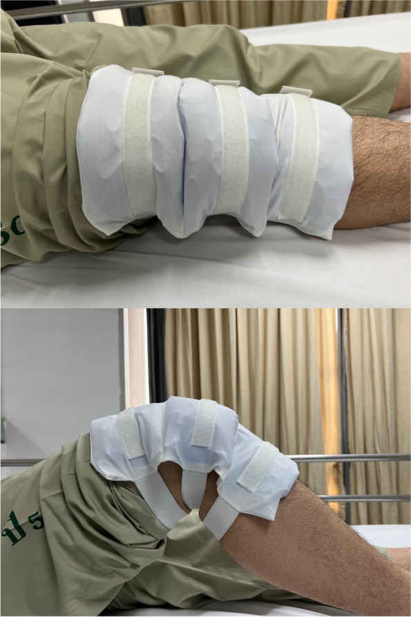 Comparison of three cryotherapy techniques for early post-TKA pain control in terms of efficacy and patient satisfaction: a randomized controlled trial.