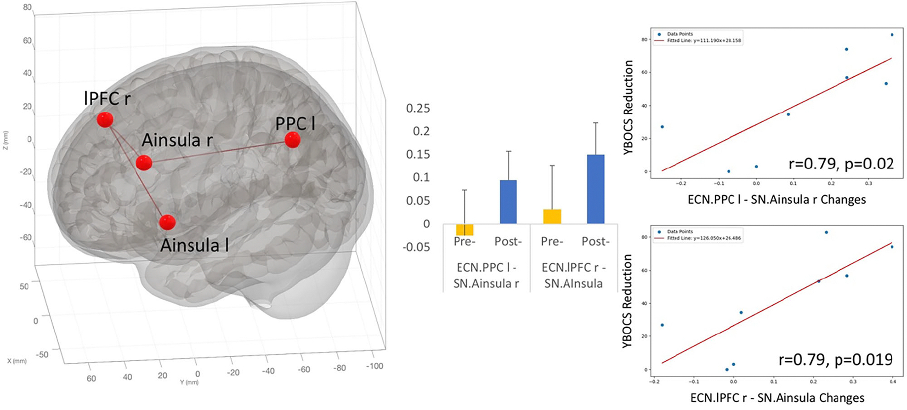 Single-dose psilocybin alters resting state functional networks in patients with body dysmorphic disorder.