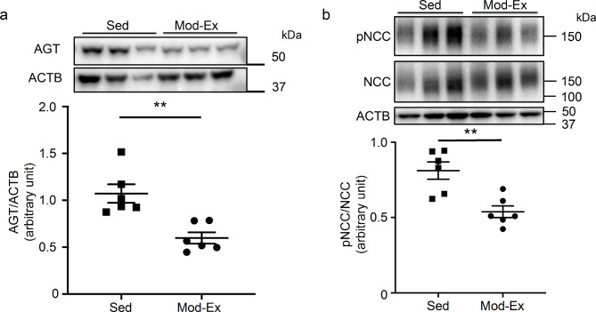 Decreased nitric oxide production is a novel therapeutic target for salt-induced nocturnal polyuria in aging.