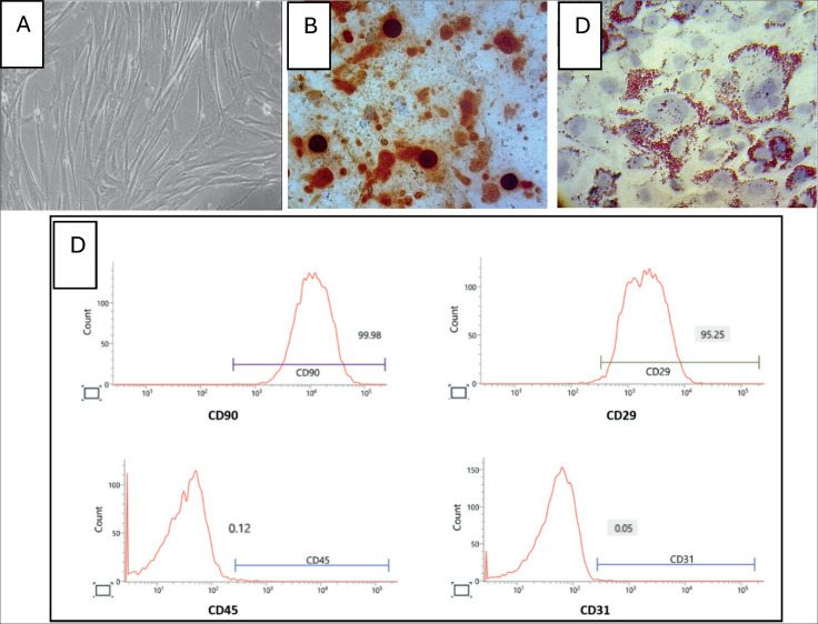 Synergistic Effects of Hypoxia-Preconditioned Mesenchymal Stem Cells Secretome and Alkaline Water in Alleviating Oxidative Stress and Inflammation in Type 2 Diabetic Rats.