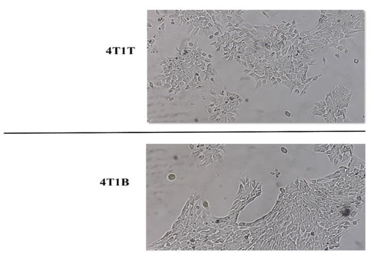 Anti-cancer effects of frankincense methanolic extract on brain metastatic breast cancer cells.