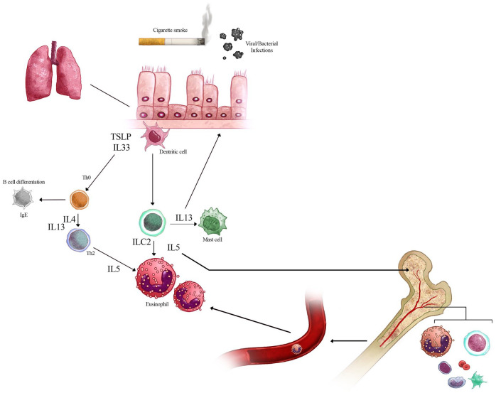 Eosinophils in chronic obstructive pulmonary disease.