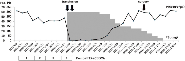A Case Report of Severe Thrombocytopenic Purpura during Neoadjuvant Pembrolizumab Administration for Triple-Negative Breast Cancer.