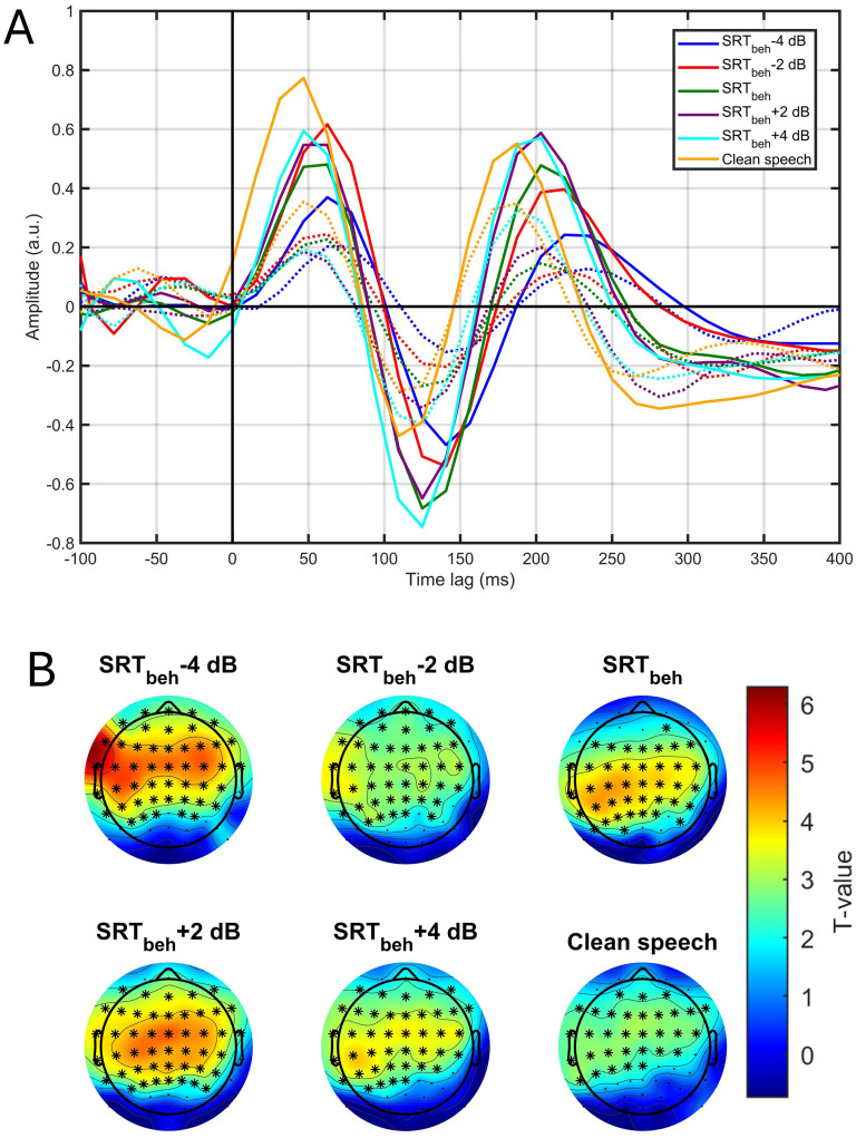Age-Related Differences in EEG-Based Speech Reception Threshold Estimation Using Scalp and Ear-EEG.