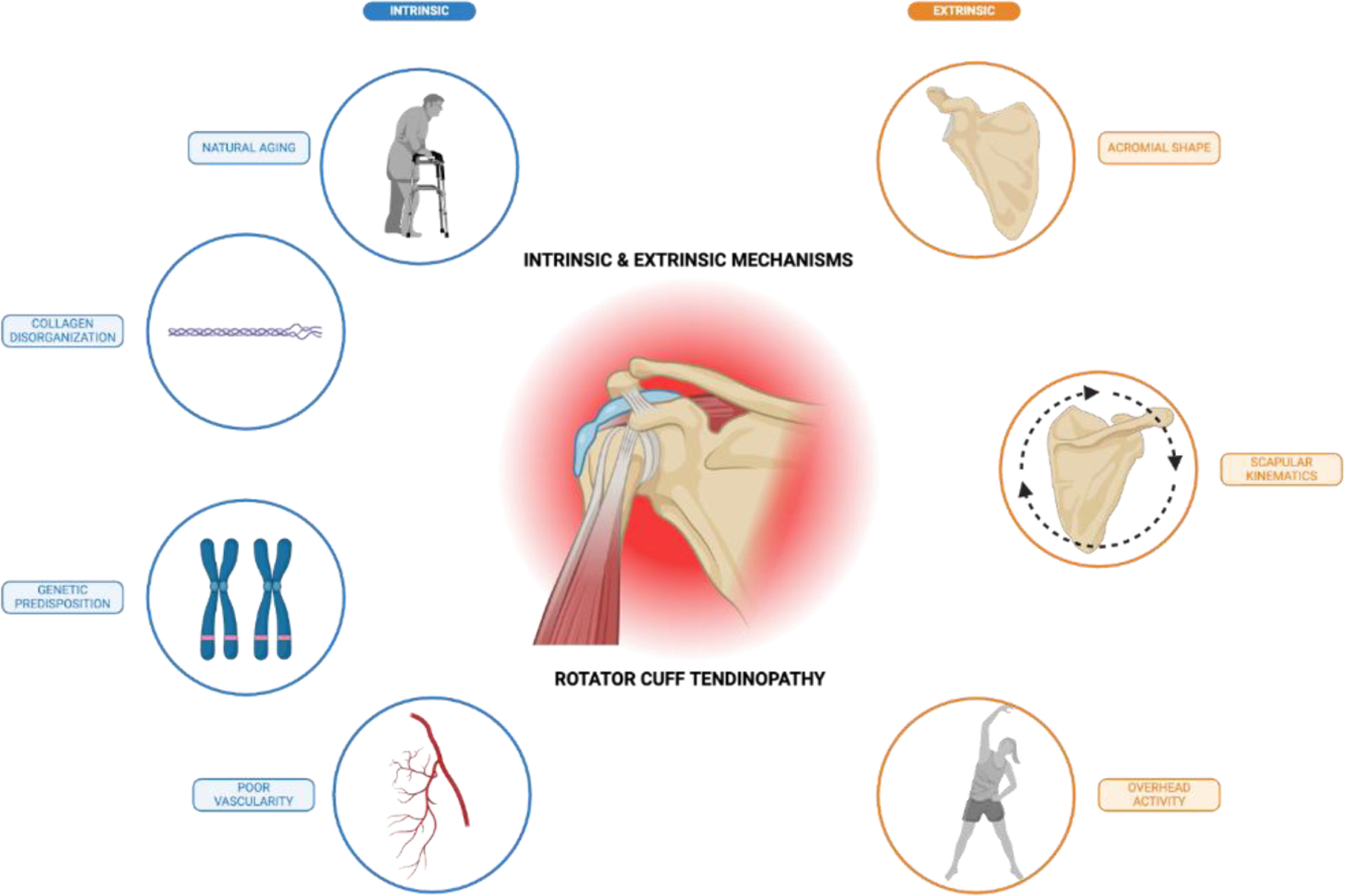 Calcified vs. Non-Calcified Tendinopathy of the Rotator Cuff: Clinical Presentations, Prognostic Implications, and Emerging Therapeutic Strategies.