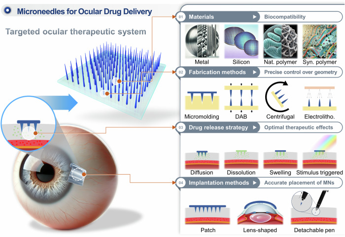 Microneedles for controlled and sustained intraocular drug delivery.