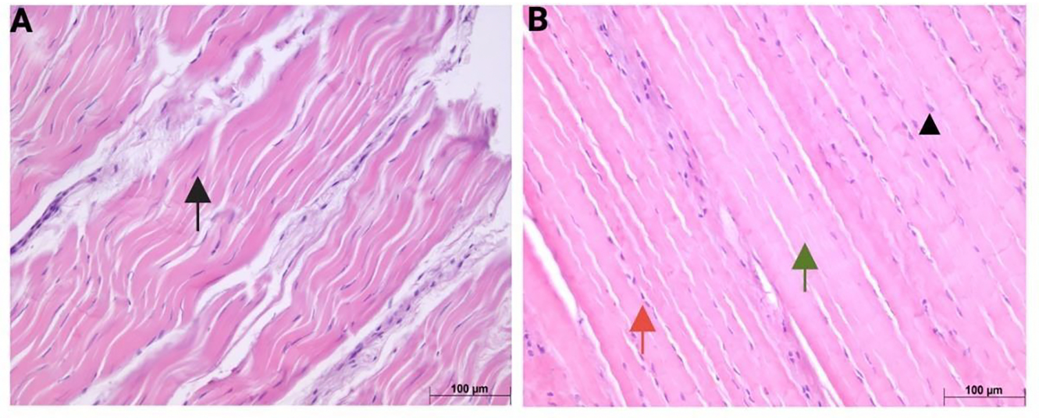 Modulation of EGR1 Expression by Hyperglycemia in Swine Rotator Cuff Tendons.