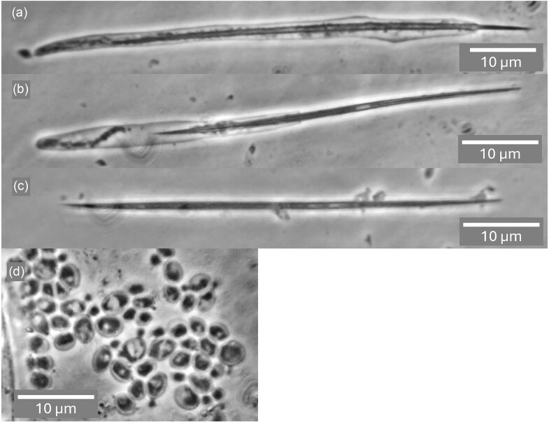 Reviving Élie Metschnikoff's Monospora: the obligately parasitic yeast Australozyma monospora sp. nov.