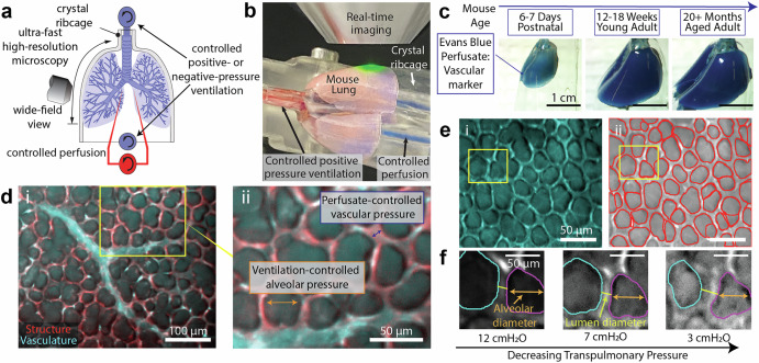 Micromechanics of lung capillaries across mouse lifespan and in positive- vs negative-pressure ventilation.