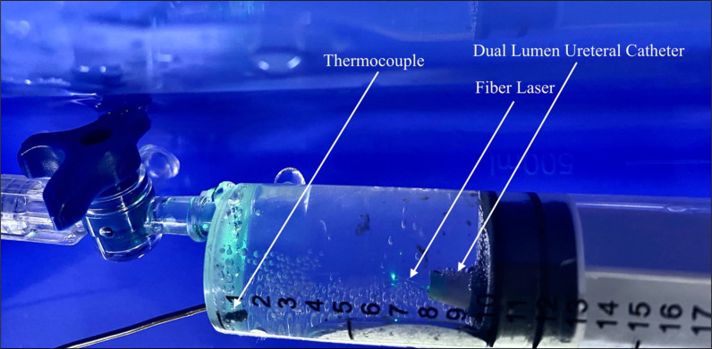 Investigation of irrigation fluid temperature variations caused by thulium fiber laser with various settings and comparison with Ho:YAG laser: An <i>in vitro</i> experimental study.