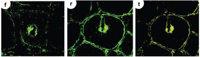 Inflammatory Myopathies and Autoimmune Gluten-related Disorders: A Scoping Review of Pathophysiological Interconnections and Hypothesis.
