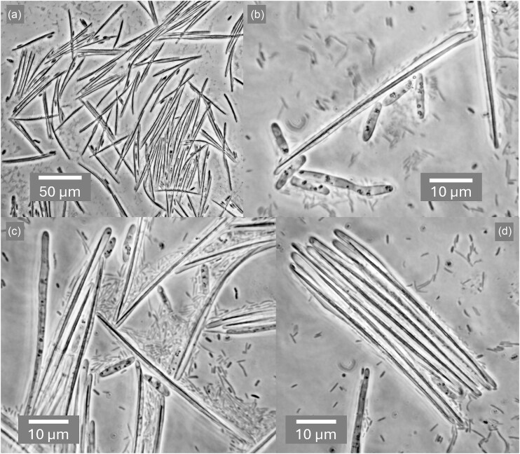 Reviving Élie Metschnikoff's Monospora: the obligately parasitic yeast Australozyma monospora sp. nov.