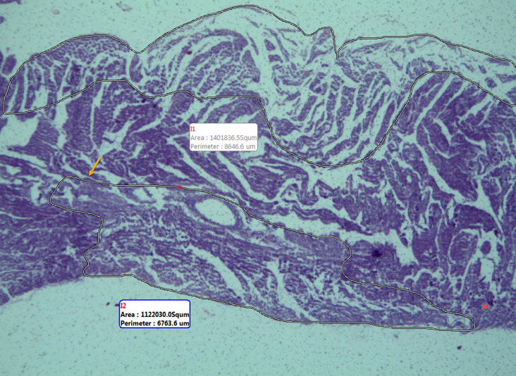 The mechanism of vascular adhesion molecule-1 in an ischemia-reperfusion cardia model.