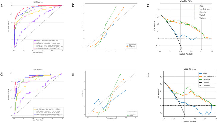 Integrating Peritumoral and Intratumoral Radiomics with Deep Learning for Preoperative Prediction of Lymphovascular Invasion in Invasive Breast Cancer Using DCE-MRI.