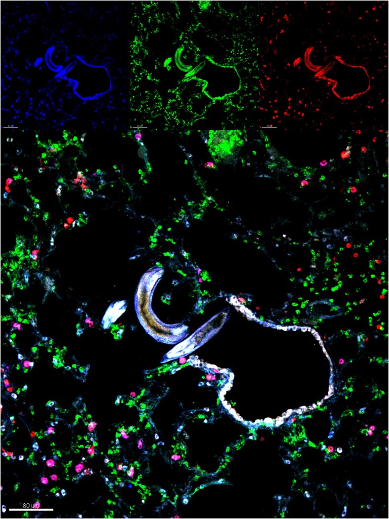 Helminth infections affect host immune responses to viral infections and vaccines.