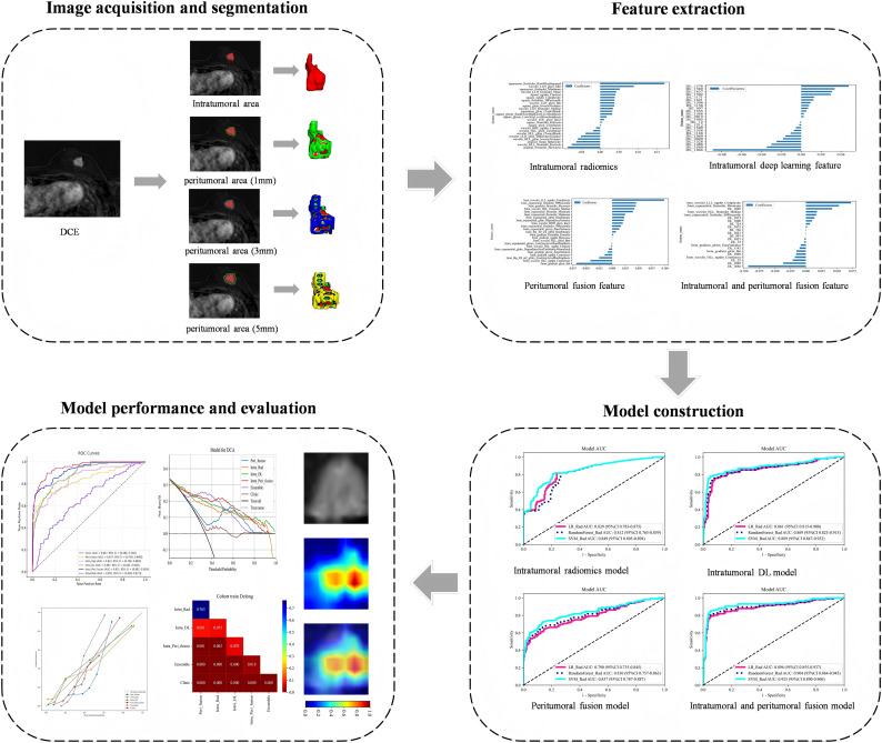 Integrating Peritumoral and Intratumoral Radiomics with Deep Learning for Preoperative Prediction of Lymphovascular Invasion in Invasive Breast Cancer Using DCE-MRI.