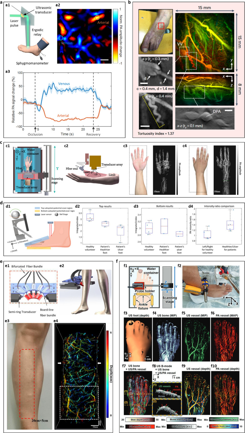 Emerging Photoacoustic Imaging Techniques for Peripheral Arterial Disease.