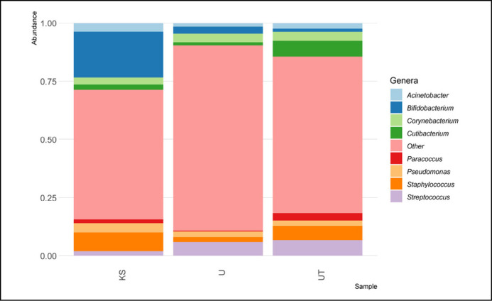 Comparison of the microbiome of bladder urine, upper urinary tract urine, and kidney stones in patients with urolithiasis.