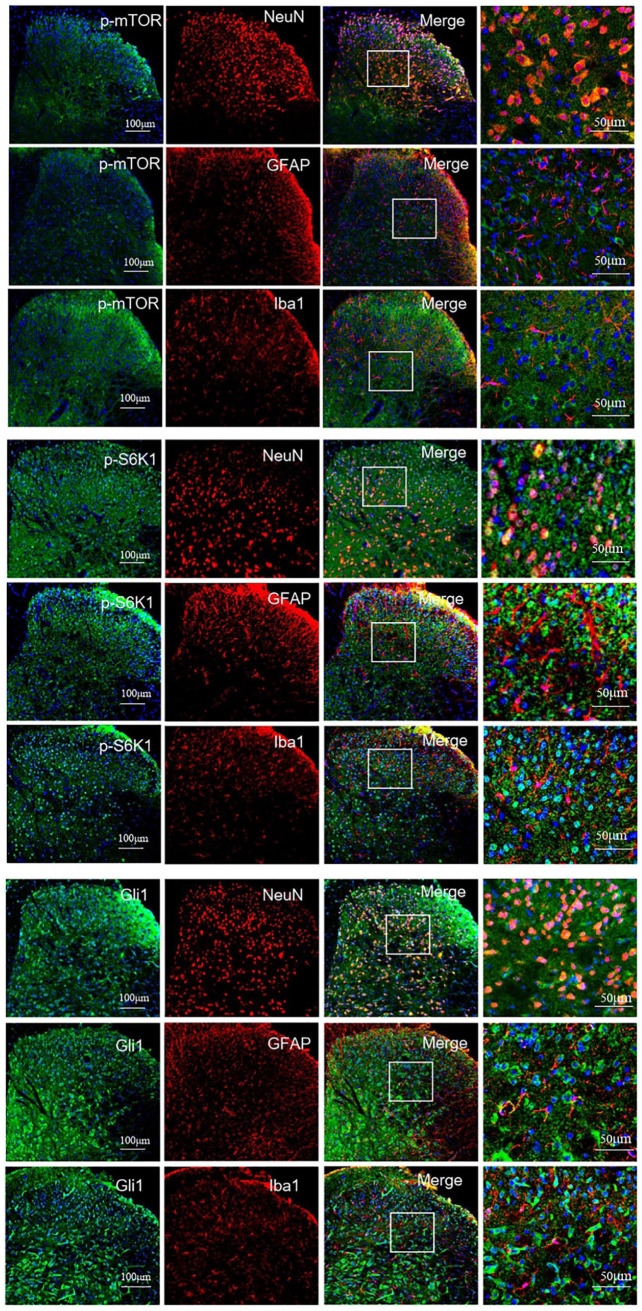 Inhibition of mTOR/S6K1/Gli1 signaling alleviates morphine-induced thermal hyperalgesia and tolerance.