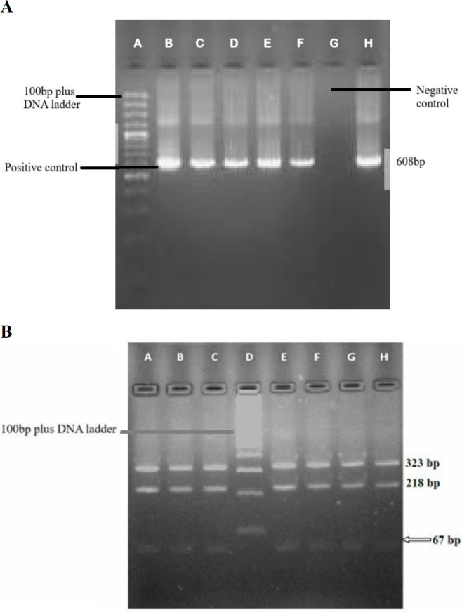 IS1311 PCR-RFLP molecular epidemiological approach for genotyping of <i>Mycobacterium avium</i> subspecies <i>paratuberculosis</i> in sheep and goat milk.