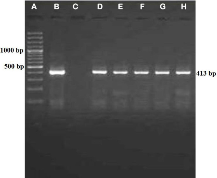 IS1311 PCR-RFLP molecular epidemiological approach for genotyping of <i>Mycobacterium avium</i> subspecies <i>paratuberculosis</i> in sheep and goat milk.